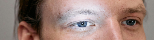 Occhi che bruciano: cause, sintomi e come stare meglio